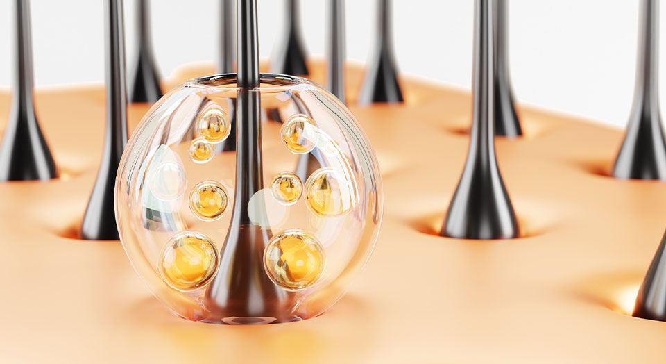 mesotherapy for hair growth,mesotherapy for hair loss