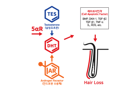 male pattern androgenetic alopecia
