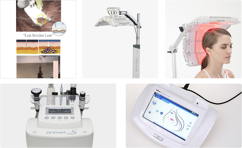scalp mesotherapy